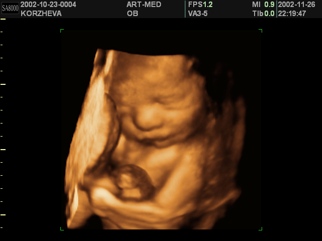 30 недель беременности фото малыша