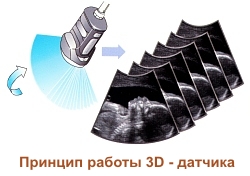 Трехмерное УЗИ при беременности 1