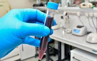 Анализы - Анализ крови на гемосиндром